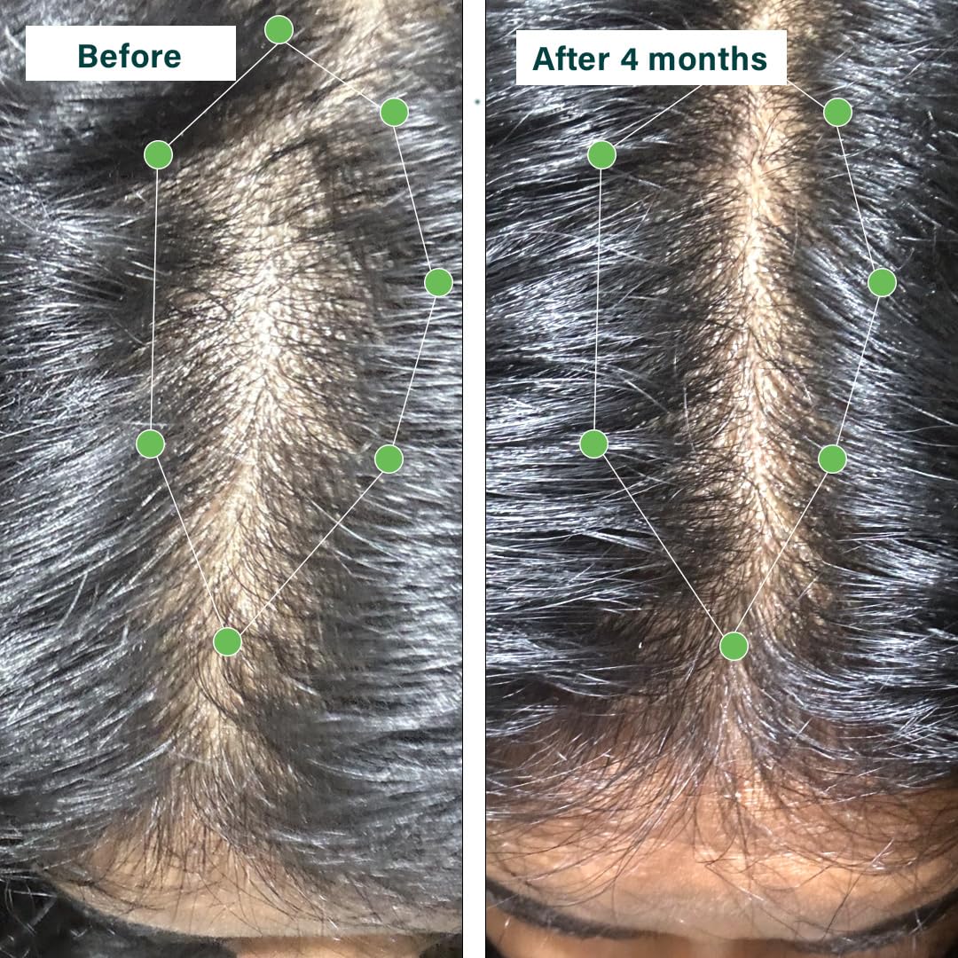 Hair Growth Tablet