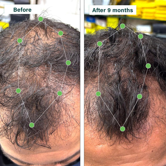 Hair Growth Tablet